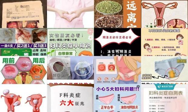 汕头女性妇科炎症