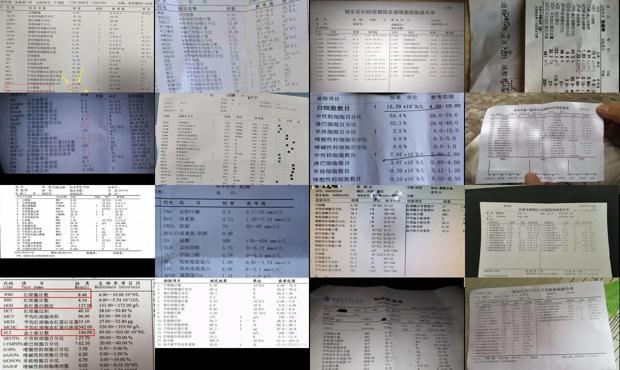 汕头血常规能检查出什么