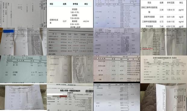 汕头雌激素六项检查
