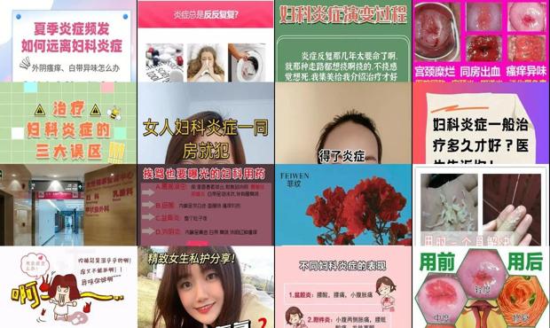 汕头妇科炎症怎么治疗