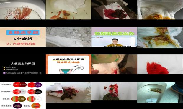 汕头坐月子大便出血怎么办