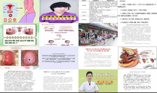 汕头宫颈炎怎么治疗