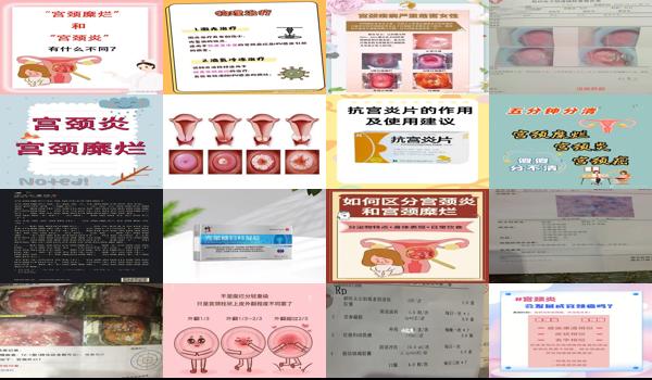 汕头慢性宫颈炎轻度糜烂不用治疗吗多少钱 - 汕头慢性宫颈炎轻度糜烂不用治疗吗