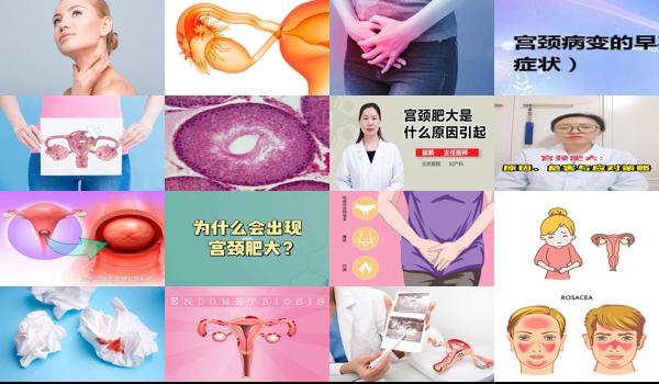 宫颈头肥大是有什么治疗方法 - 汕头宫颈肥大什么原因