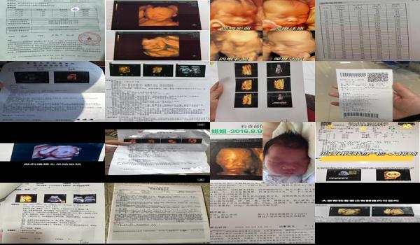 汕头4维彩超要多少钱1次 - 汕头4维彩超要多少钱