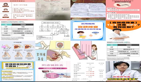 宫颈筛片价格 - 汕头宫颈筛片怎么检查