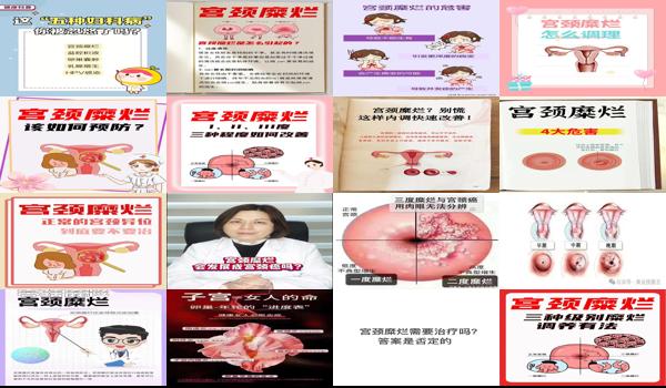 宫颈糜烂 下腹痛 - 汕头宫颈糜烂导致下腹胀痛