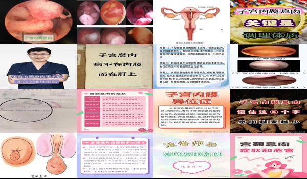 宫颈长息肉性生活会出血吗? - 汕头宫颈长息肉性生活会