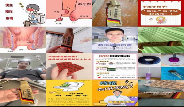 月子期间会不会得痔疮 - 汕头月子期间会有痔疮吗