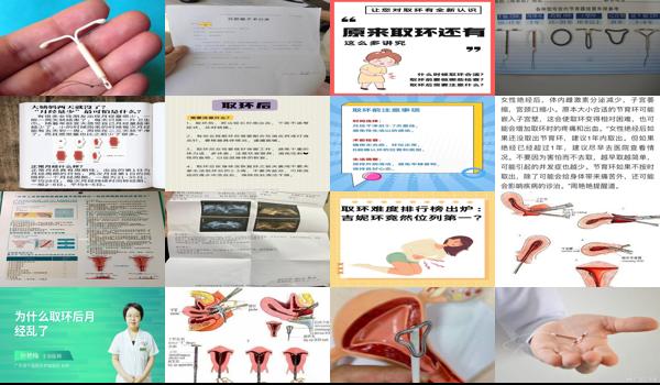 汕头没有来月经能不能取环呢 - 汕头没有来月经能不能取环