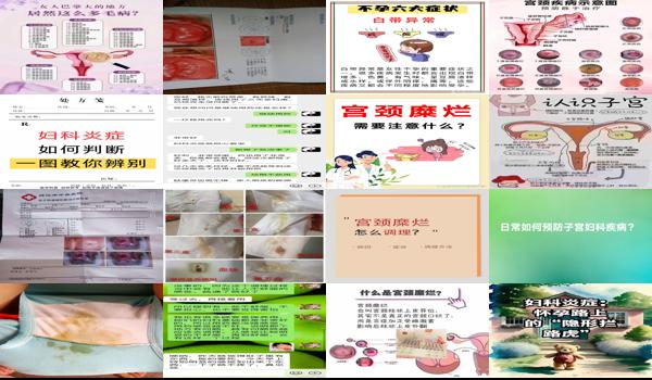 盆腔炎和宫颈糜烂的症状 - 汕头盆腔炎和宫颈糜烂导致后果