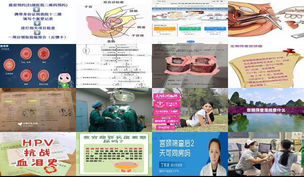 汕头要查宫颈要做什么检查多少钱 - 汕头要查宫颈要做什么检查