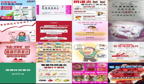 汕头碘伏霉菌性妇科炎症治疗医院 - 汕头碘伏霉菌性妇科炎症