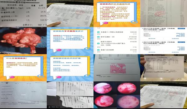 *宫颈息肉手术大概多少钱 - 汕头*宫颈息肉切除费用