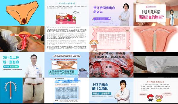 女人上环后出血几天算正常 - 汕头女人上环后出血一般多久数与正常