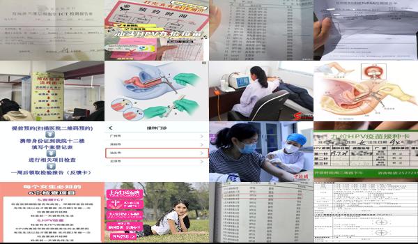 汕头宫颈检查什么项目好一点 - 汕头宫颈检查什么项目好