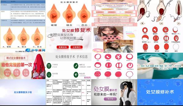 汕头修复处女摸手的医院 - 汕头修复处女摸手术多少钱
