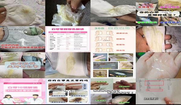 黄水有异味是什么妇科? - 汕头黄水有气味白带不正常是什么妇科炎症