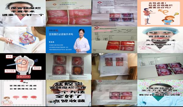做了宫颈糜烂手术多久可以同房? - 汕头宫颈糜烂动了手术 好久才可以同房