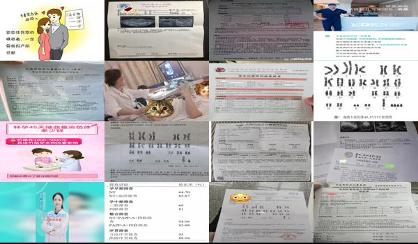汕头孕妇怎么做染色体检查多少钱啊 - 汕头孕妇怎么做染色体检查多少钱
