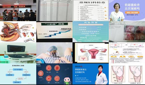 汕头查宫颈要做什么检查呢 - 汕头查宫颈要做什么检查