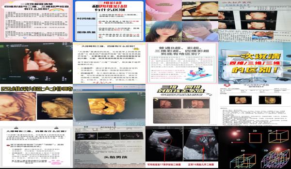 汕头四维多少钱 - 汕头三维和四维的区别