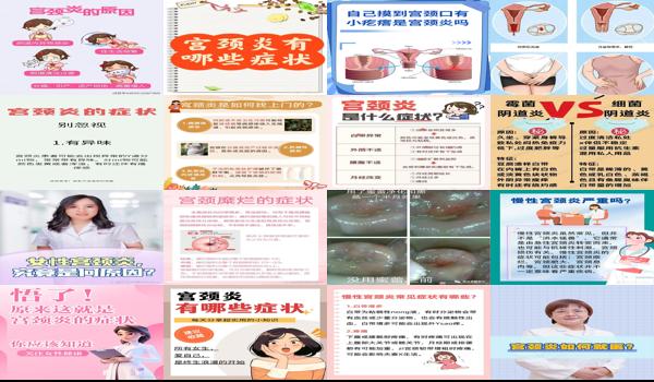 汕头宫颈疫苗哪里可以打 - 汕头宫颈炎的早期症状表现