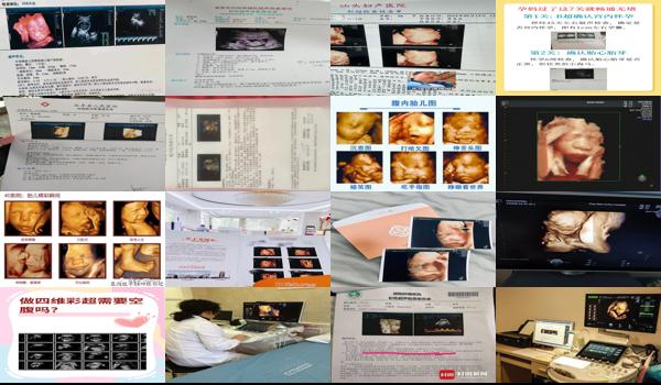 汕头保健医院做四维彩超多少钱一次 - 汕头保健医院做四维彩超多少钱