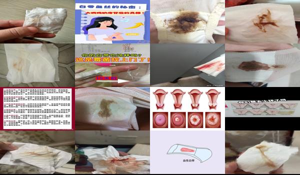 上环会影响分泌物吗 - 汕头上环后会影响白带有血丝吗