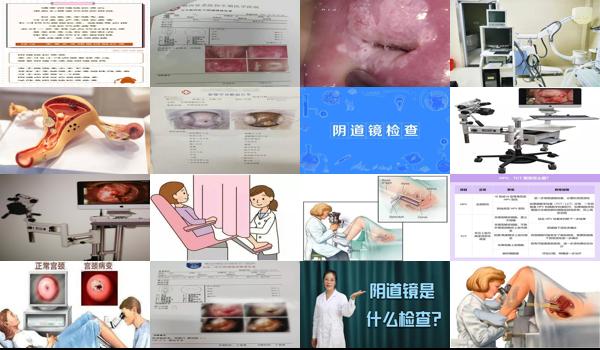 汕头妇科检查好不好 - 汕头阴道镜怎么检查疼吗?