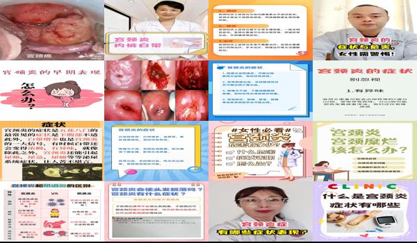宫颈浅怎么办 - 汕头宫颈淡有那些症状