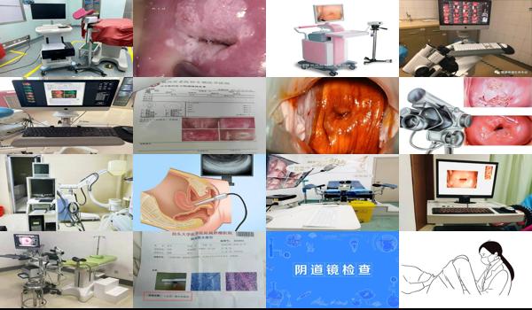 汕头妇科检查好不好 - 汕头阴道镜检查什么东西