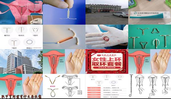 汕头上环哪个医院好点 - 汕头上环哪个医院好