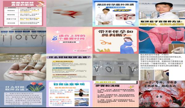 汕头取环去哪个医院好 - 汕头带环怀孕取环流产注意什么