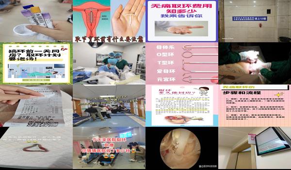 汕头能取环的医院吗多少钱 - 汕头能取环的医院吗