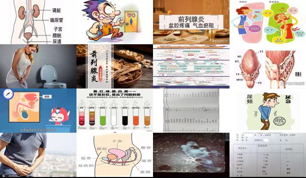 尿频尿急去检查估计花多少钱 - 汕头尿频尿急要做什么检查