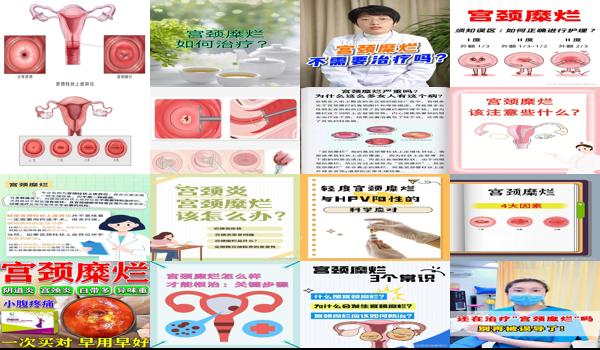 汕头宫颈糜烂疗法哪家好 - 汕头宫颈糜烂疗法