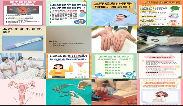 汕头哪家医院上环比较好 - 汕头上环后有可能会怀孕吗