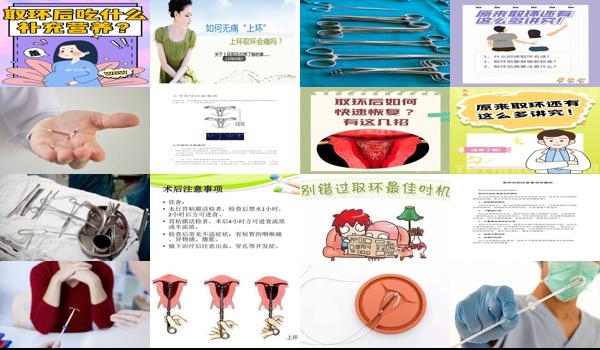 汕头去取环前要注意哪些事项和饮食 - 汕头去取环前要注意哪些事项