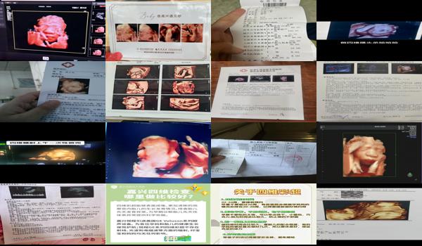 汕头打四维彩超要多少钱一次 - 汕头打四维彩超要多少钱