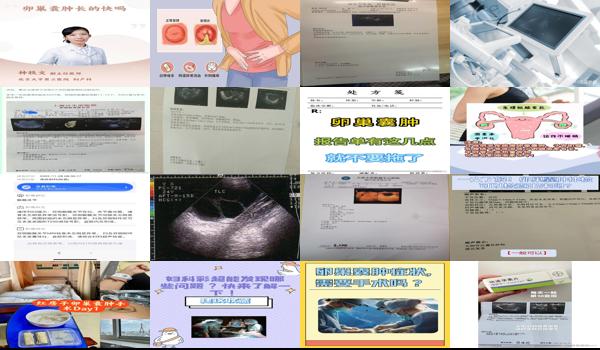汕头妇科常规检查能检查出卵巢*吗 - 汕头妇科常规检查能检查出卵巢*吗