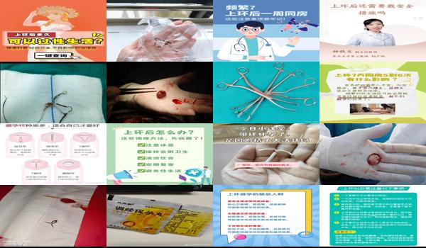 上环后要平躺床上吗能久坐吗 - 汕头上环后用平躺