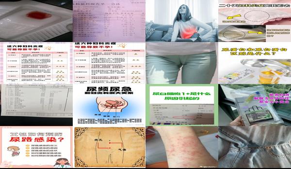 汕头有妇科炎症白尿医院吗 - 汕头有妇科炎症白尿